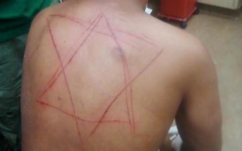 Antisemitismo negli USA